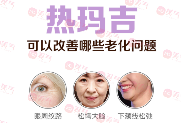 上海九院熱瑪吉怎么樣? 上海九院熱瑪吉怎么樣?