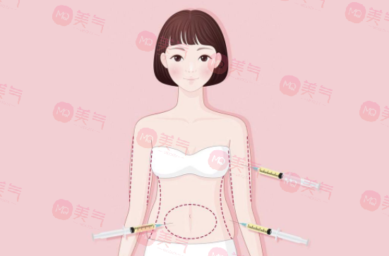 南醫(yī)大友誼吸脂價格是多少 南醫(yī)大友誼吸脂價格是多少