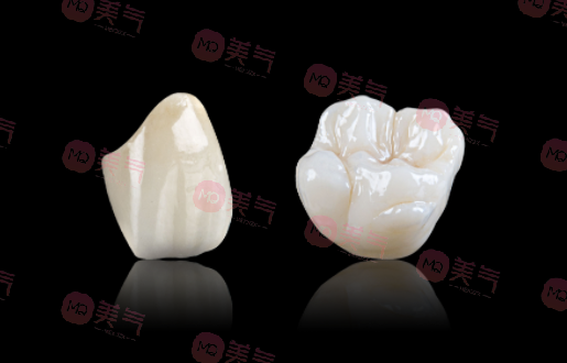 廣州全瓷牙價(jià)格多少？2023費(fèi)用明細(xì)-全瓷牙優(yōu)勢(shì)、注意事項(xiàng)附上