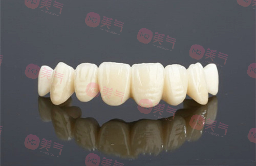 鎳鉻烤瓷牙和鈷鉻烤瓷牙哪個(gè)好，烤瓷牙修復(fù)優(yōu)缺點(diǎn)有哪些？