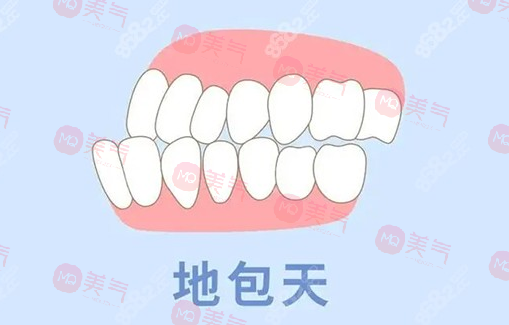 地包天矯正需要多少費用？骨性地包天整形費用2-4萬起