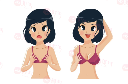 深圳美萊隆胸僅需8770元起！技術優(yōu)勢和整友反饋勸你快來