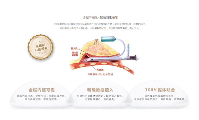 內(nèi)窺鏡隆胸